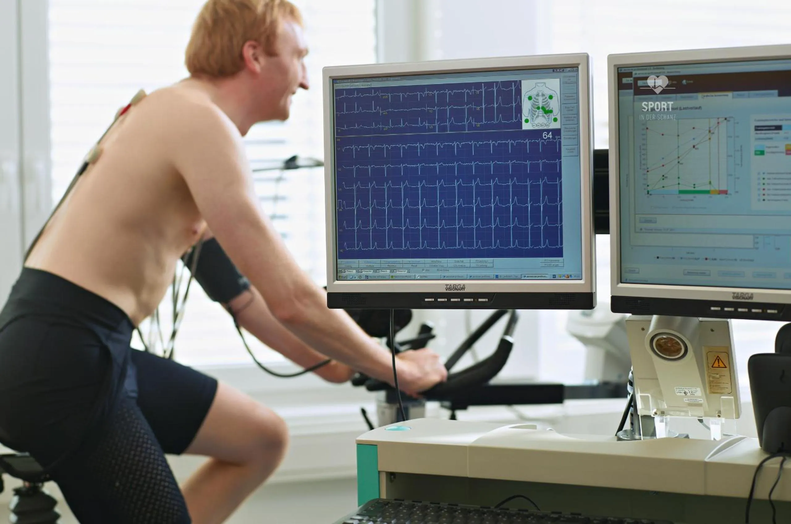 Fitness centre/facilities in Hotel B&B "Zur Schanz"